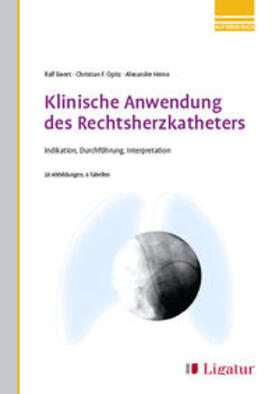 Ewert / Opitz / Heine | Klinische Anwendung des Rechtsherzkatheters | Buch | 978-3-940407-70-2 | sack.de