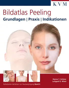 Schürer / Wiest |  Bildatlas Peeling | Buch |  Sack Fachmedien