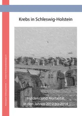 Pritzkuleit / Holzmann / Eisemann |  Krebs in Schleswig Holstein | Buch |  Sack Fachmedien