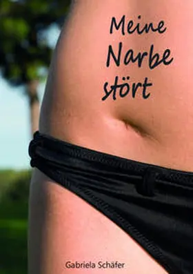 Schäfer |  Meine Narbe stört | Buch |  Sack Fachmedien