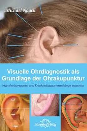 Noack |  Visuelle Ohrdiagnostik als Grundlage der Ohrakupunktur | Buch |  Sack Fachmedien