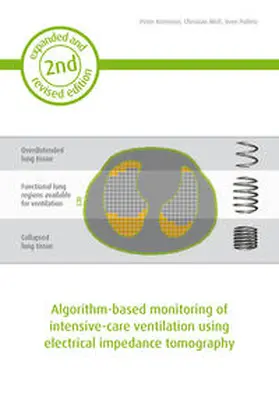 Kremeier / Woll / Pulletz | Algorithm-based monitoring of intensive-care ventilation using electrical impedance tomography | Buch | 978-3-95853-298-4 | www.sack.de