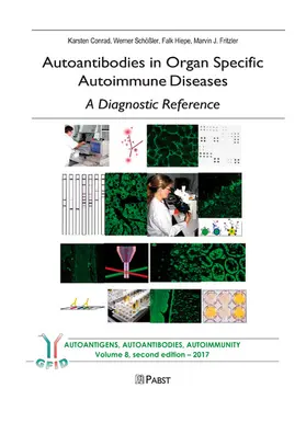 Conrad / Schößler / Hiepe |  Autoantibodies in Organ Specific Autoimmune Diseases – A Diagnostic Reference | eBook | Sack Fachmedien
