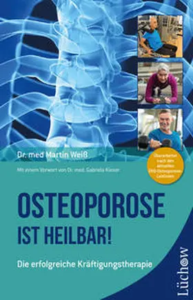 Weiß | Osteoporose ist heilbar! | Buch | 978-3-95883-499-6 | www.sack.de