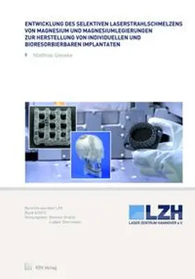 Gieseke / Overmeyer |  Entwicklung des selektiven Laserstrahlschmelzens von Magnesium und Magnesiumlegierungen zur Herstellung von individuellen und bioresorbierbaren Implantaten | Buch |  Sack Fachmedien