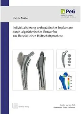 Müller |  Individualisierung orthopädischer Implantate durch algorithmisches Entwerfen am Beispiel einer Hüftschaftprothese | Buch |  Sack Fachmedien