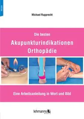Rupprecht |  Die besten Akupunkturindikationen Orthopädie | eBook | Sack Fachmedien