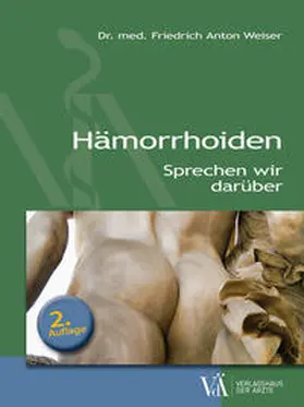 Weiser, MCs |  Hämorrhoiden | Buch |  Sack Fachmedien