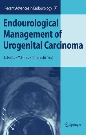 Naito / Hirao / Terachi |  Endourological Management of Urogenital Carcinoma | Buch |  Sack Fachmedien