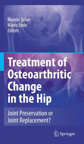 Sofue / Endo |  Treatment of Osteoarthritic Change in the Hip | eBook | Sack Fachmedien