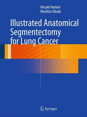 Nomori / Okada | Illustrated Anatomical Segmentectomy for Lung Cancer | E-Book | www.sack.de