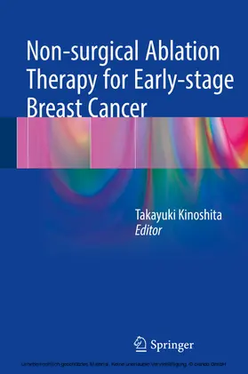 Kinoshita |  Non-surgical Ablation Therapy for Early-stage Breast Cancer | eBook | Sack Fachmedien