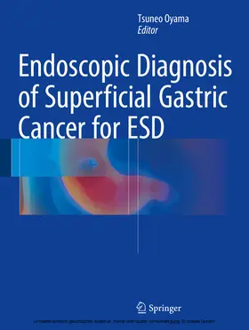 Oyama | Endoscopic Diagnosis of Superficial Gastric Cancer for ESD | E-Book | www.sack.de