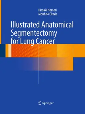 Nomori / Okada |  Illustrated Anatomical Segmentectomy for Lung Cancer | Buch |  Sack Fachmedien