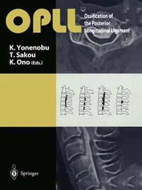 Yonenobu / Sakou / Ono |  OPLL | eBook | Sack Fachmedien