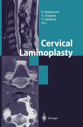 Nakamura / Toyama / Hoshino |  Cervical Laminoplasty | Buch |  Sack Fachmedien