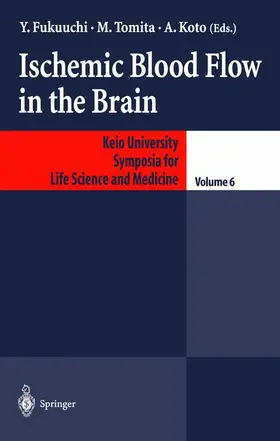 Fukuuchi / Koto / Tomita | Ischemic Blood Flow in the Brain | Buch | 978-4-431-67990-5 | sack.de