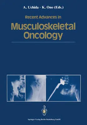 Uchida / Ono |  Recent Advances in Musculoskeletal Oncology | eBook | Sack Fachmedien