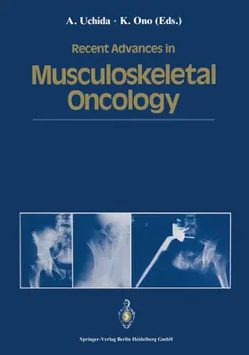 Uchida / Ono |  Recent Advances in Musculoskeletal Oncology | Buch |  Sack Fachmedien