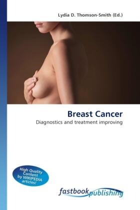 Thomson-Smith |  Breast Cancer | Buch |  Sack Fachmedien