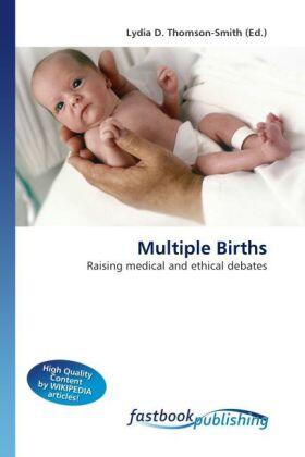 Thomson-Smith |  Multiple Births | Buch |  Sack Fachmedien