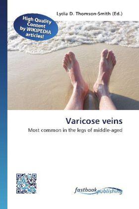 Thomson-Smith |  Varicose veins | Buch |  Sack Fachmedien