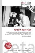 Surhone / Timpledon / Marseken |  Tattoo Removal | Buch |  Sack Fachmedien