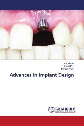 Mishra / Puri / Khatri |  Advances in Implant Design | Buch |  Sack Fachmedien