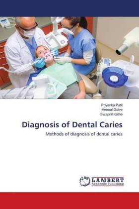 Patil / Gulve / Kolhe |  Diagnosis of Dental Caries | Buch |  Sack Fachmedien