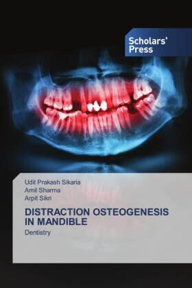 Sikaria / Sharma / Sikri |  DISTRACTION OSTEOGENESIS IN MANDIBLE | Buch |  Sack Fachmedien