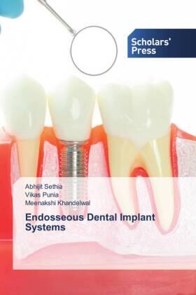 Sethia / Punia / Khandelwal |  Endosseous Dental Implant Systems | Buch |  Sack Fachmedien