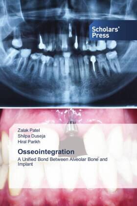 Patel / Duseja / Parikh |  Osseointegration | Buch |  Sack Fachmedien