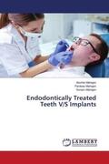 Mahajan |  Endodontically Treated Teeth V/S Implants | Buch |  Sack Fachmedien