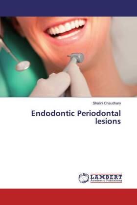 Chaudhary |  Endodontic Periodontal lesions | Buch |  Sack Fachmedien