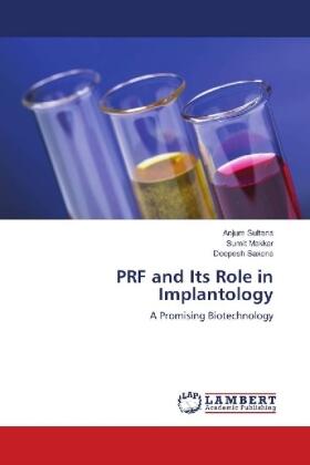 Sultana / Makkar / Saxena |  PRF and Its Role in Implantology | Buch |  Sack Fachmedien