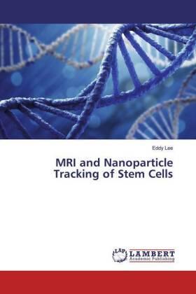 Lee |  MRI and Nanoparticle Tracking of Stem Cells | Buch |  Sack Fachmedien
