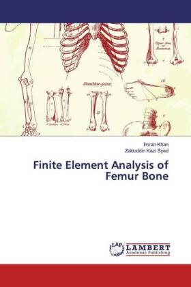 Khan / Kazi Syed |  Finite Element Analysis of Femur Bone | Buch |  Sack Fachmedien