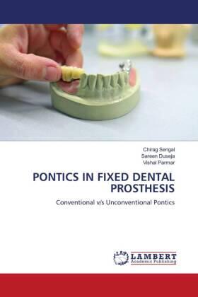 Sengal / Duseja / Parmar |  PONTICS IN FIXED DENTAL PROSTHESIS | Buch |  Sack Fachmedien