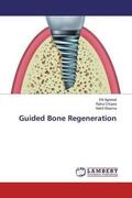 Agrawal / Chopra / Sharma |  Guided Bone Regeneration | Buch |  Sack Fachmedien