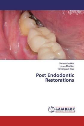 Makkar / Mushtaq / Kaur | Post Endodontic Restorations | Buch | 978-620-026830-3 | sack.de