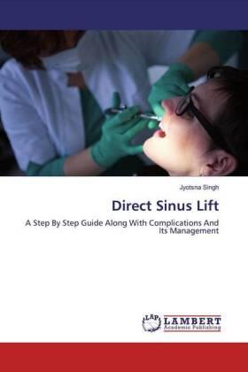 Singh |  Direct Sinus Lift | Buch |  Sack Fachmedien