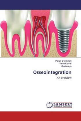 Singh / Kumar / Arya |  Osseointegration | Buch |  Sack Fachmedien