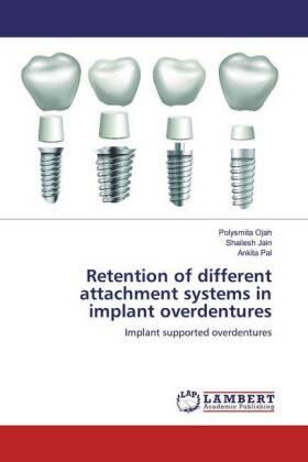 Ojah / Jain / Pal |  Retention of different attachment systems in implant overdentures | Buch |  Sack Fachmedien