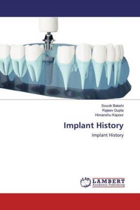 Bakshi / Gupta / Kapoor |  Implant History | Buch |  Sack Fachmedien