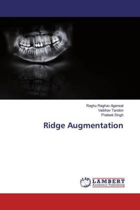 Agarwal / Tandon / Singh |  Ridge Augmentation | Buch |  Sack Fachmedien