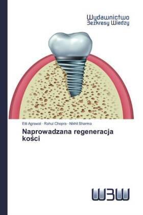 Agrawal / Chopra / Sharma |  Naprowadzana regeneracja ko¿ci | Buch |  Sack Fachmedien