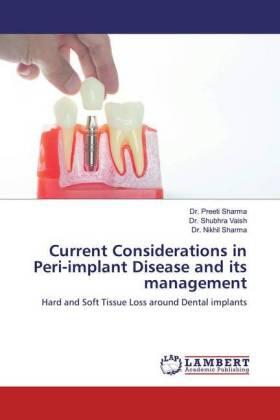 Sharma / Vaish |  Current Considerations in Peri-implant Disease and its management | Buch |  Sack Fachmedien