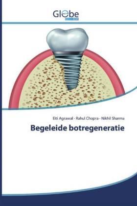 Agrawal / Chopra / Sharma |  Begeleide botregeneratie | Buch |  Sack Fachmedien