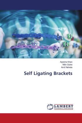 Khan / Gulve / Nehete |  Self Ligating Brackets | Buch |  Sack Fachmedien