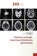 Belhachmi / Elmoustarchid / Miloudi |  Fistules carotido-caverneux bilatérales spontanées | Buch |  Sack Fachmedien